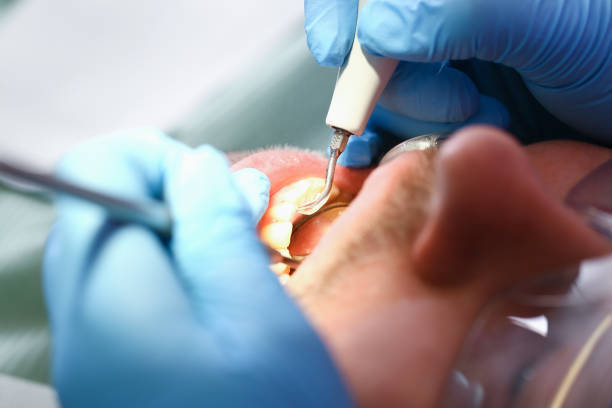 Best Urgent Care for Lost Fillings or Crowns in Shasta Lake, CA