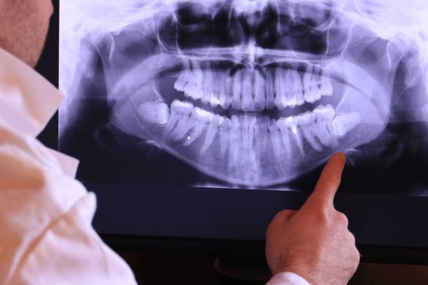 Best Emergency Treatment for Dental Infections or Abscesses in Shasta Lake, CA